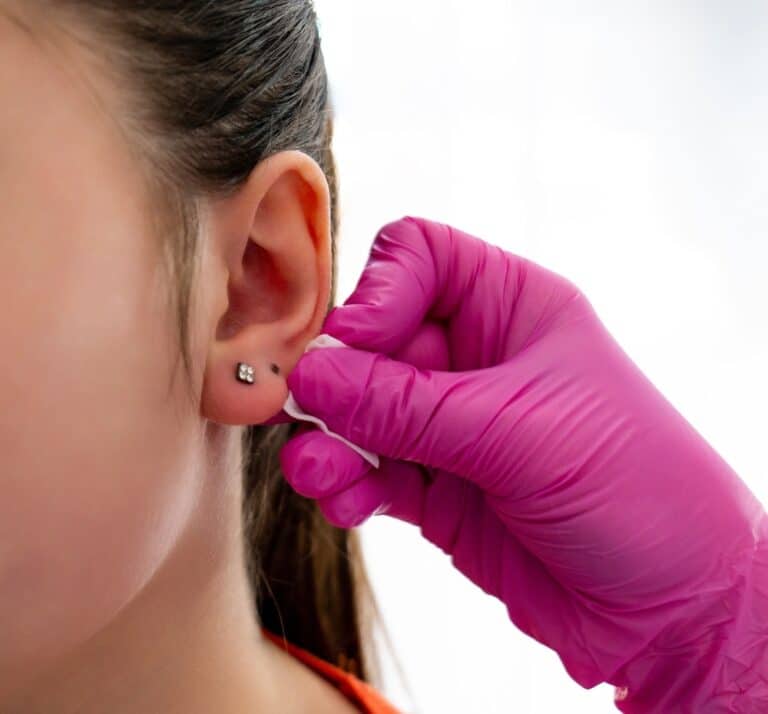 How To Safely Remove Earring Stuck In Earlobe