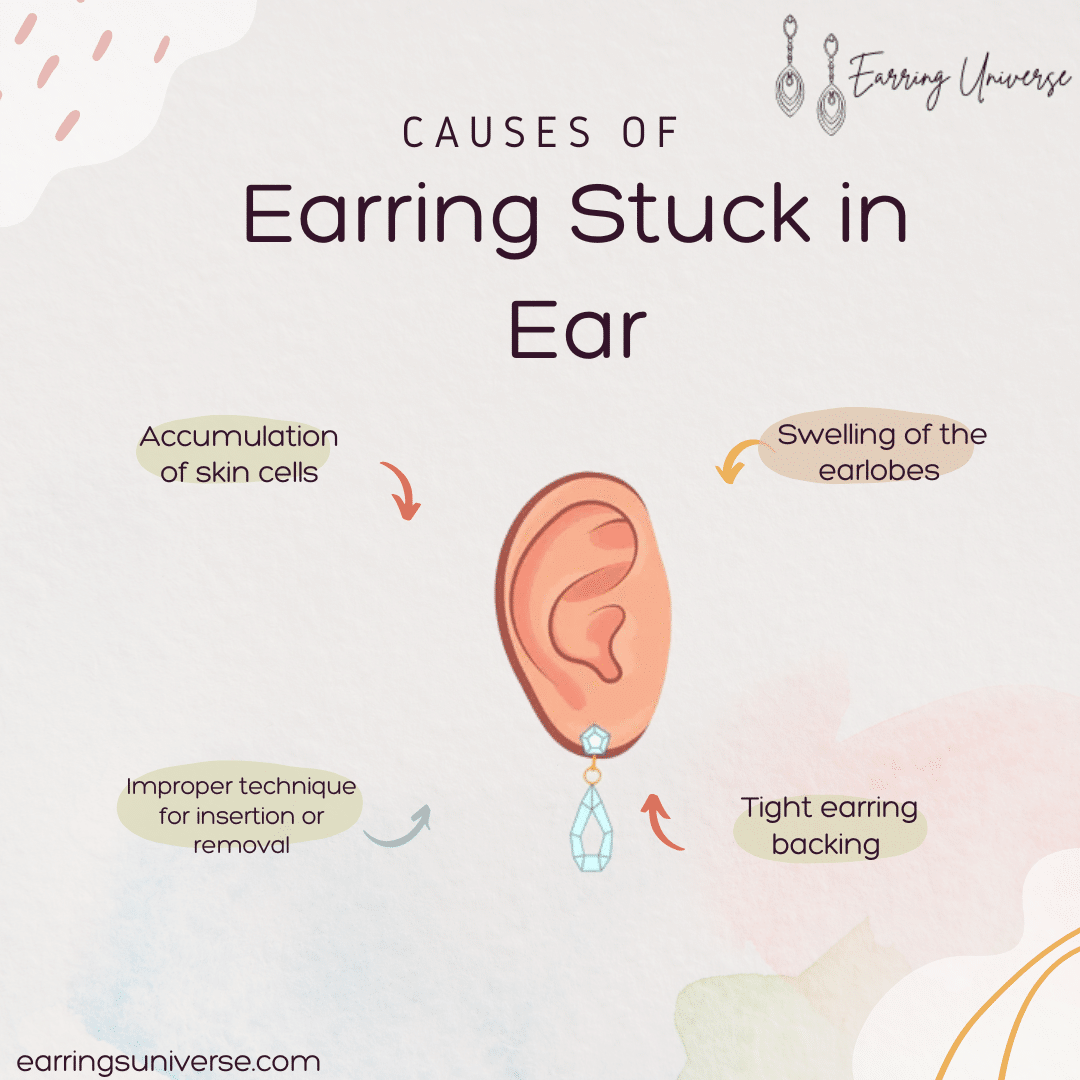 Causes of Earring Stuck in Ear