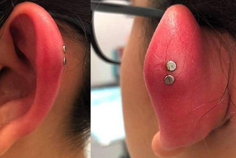 a newly pierced red ear a newly pierced red ear